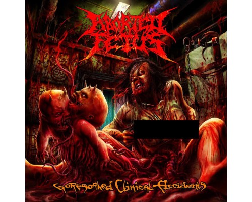 Aborted Fetus - Goresoaked Clinical Accidents