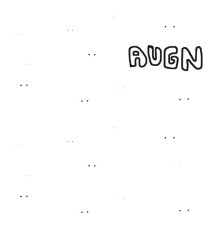 Augn - GRAUER STAR