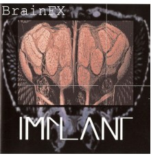 Implant - BrainFX