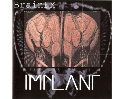 Implant - BrainFX