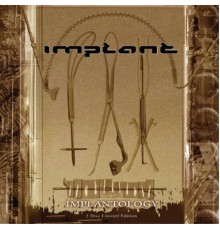 Implant - The Surgical Files