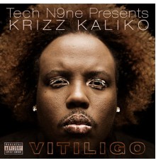 Krizz Kaliko - Vitiligo