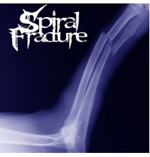 Spiral Fracture - Spiral Fracture