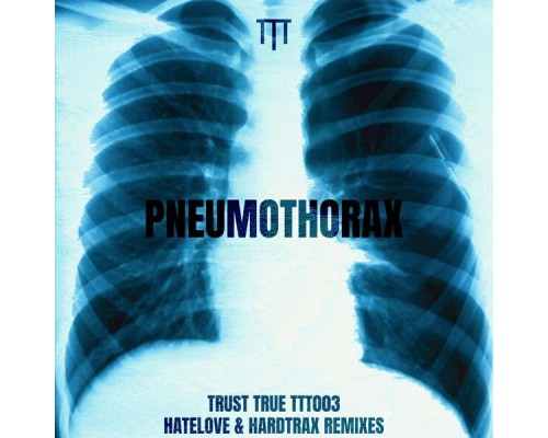 Trust True - Pneumothorax