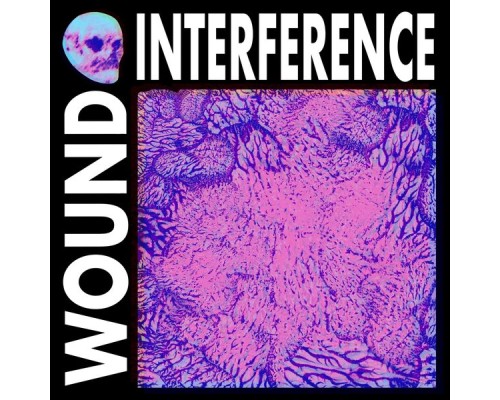 WOUND INTERFERENCE - WOUND INTERFERENCE WOUND INTERFERENCE - WOUND INTERFERENCE